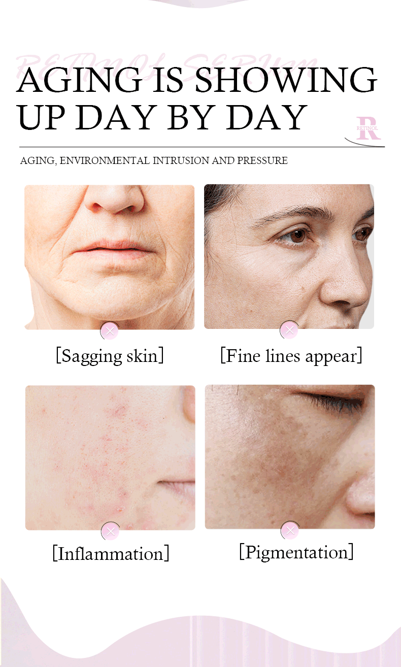 Trendify Aura's QANZRE Retinol A Serum