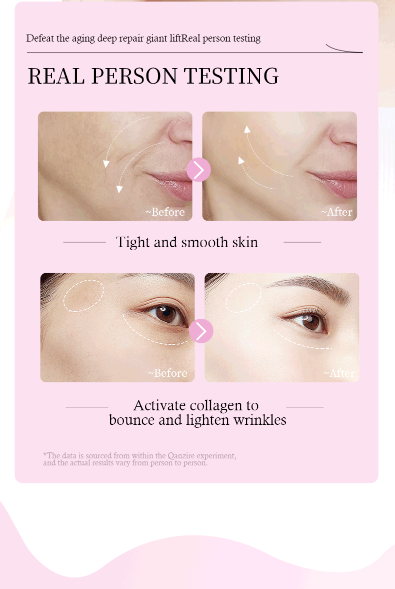 Trendify Aura's QANZRE Retinol A Serum